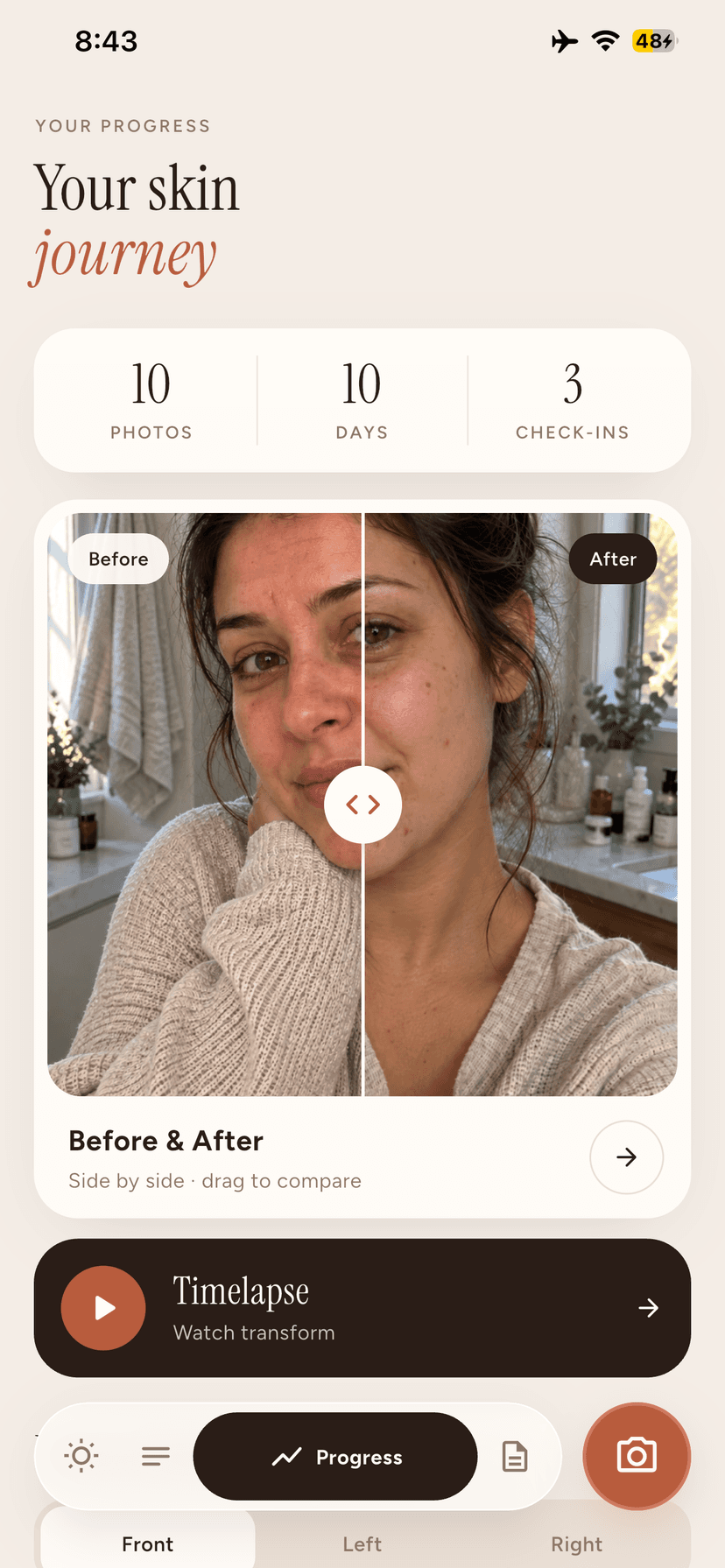 Zavelo progress and before after comparison
